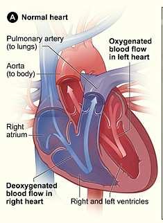 Tetralogia de Fallot : QUATRO alterações 9,6/10.000 1. Defeito Sept Ventricular Mistura de sangue VE e VD 2. Aorta Cavalgada Mistura de sangue VE e VD 3.Estenose da Art.