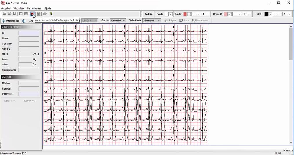 3. Após a estabilização do sinal do ECG,