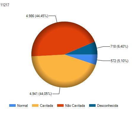 Padrão Radiológico TB Pulmonar Norte