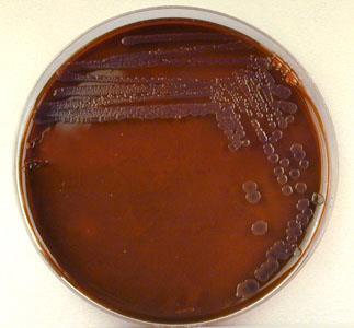 E.M.B. (Eosina Azul de metileno) Para isolamento de Enterobactérias (Gram negativo) Corantes inibem Gram-positivo Brilho verde metálico Escherichia coli?