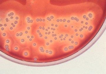: Meio ágar sangue para detectar a presença de Streptococcus pyogenes (forma-se um halo claro em torno da colônia pela lise das hemáceas) de Enriquecimento: Semelhante ao seletivo, mas suplementado