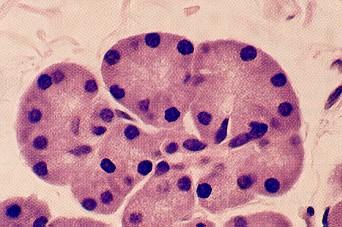 Pâncreas exócrino Pancreatite Diagnóstico: Degradação enzimática de Carboidratos, lipídeos e proteínas Sinais clínicos Imagem (US/RX) Exames laboratoriais Amilase Lipase PLI Exames complementares