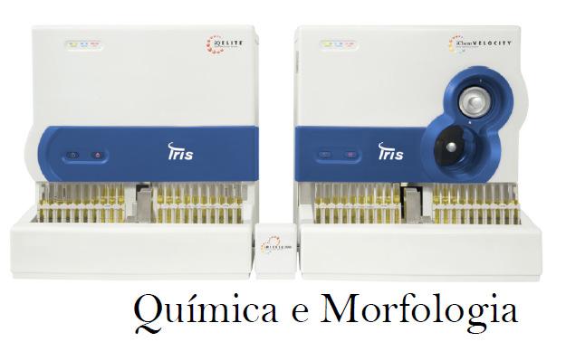 Estudo de Implantação para Automatização Total do Setor de Urinálise Equipamentos IQ200 Sedimento / Velocity - Fita