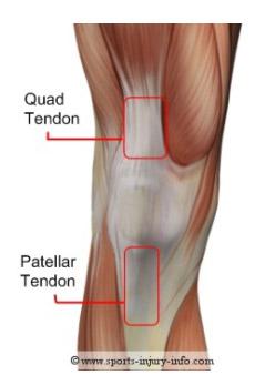 O tendão patelar, que também pode ser chamado de ligamento patelar (ou ligamento da patela) é um local comum de lesões, principalmente em atletas.