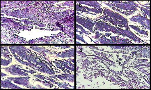 39 Classificação microscópica dos estádios de maturação gonadal para machos As observações microscópicas indicaram que as células germinativas estavam em atividade espermatogênica, mostrando vários