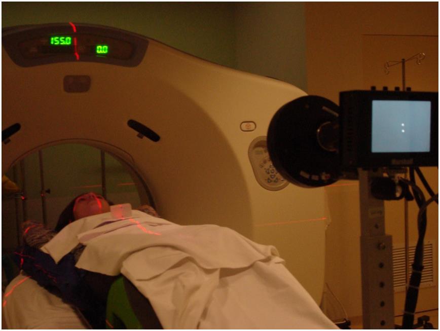 FIGURA 15. Tomógrafo utilizando a tecnologia para visualização do movimento do alvo com a respiração, o paciente é monitorado com marcadores e por uma câmara de infra-vermelho.