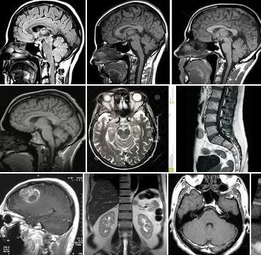 21), MRI produz imagens de órgãos por meio da interação entre os átomos de Hidrogênio que compõem os tecidos do corpo humano e um campo magnético externo o magneto do equipamento.