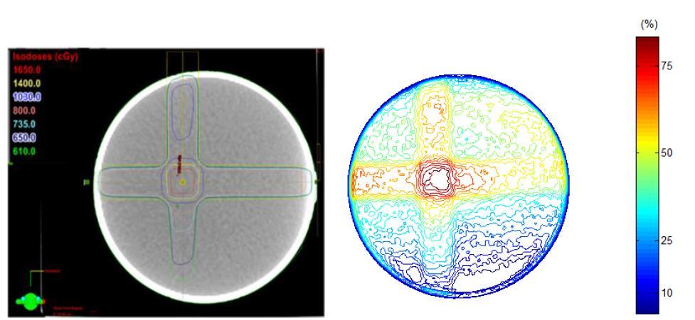 da imagem do sistema de planejamento Eclipse com a distribuição de dose e a análise da imagem de MRI pelo Matlab mostrando qualitativamente as doses, e a sua congruência.