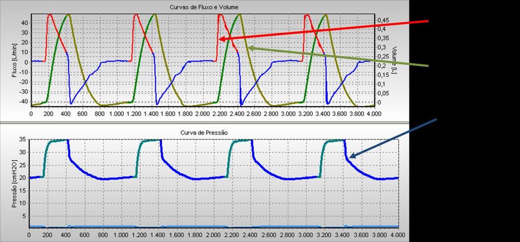 Projeto de Controladores para de Ventilação Mecânica