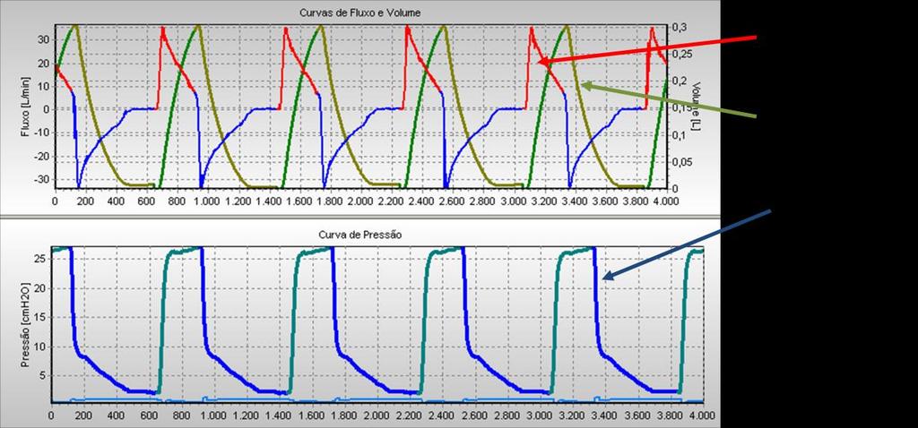 Projeto de Controladores para de Ventilação