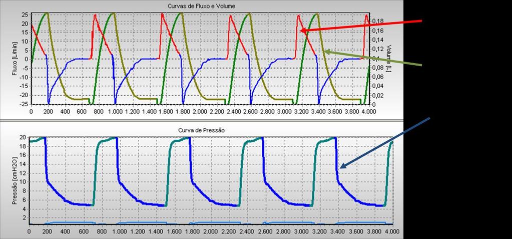 pressão limite de 27 e PEEP de 2 cmh 2 O.