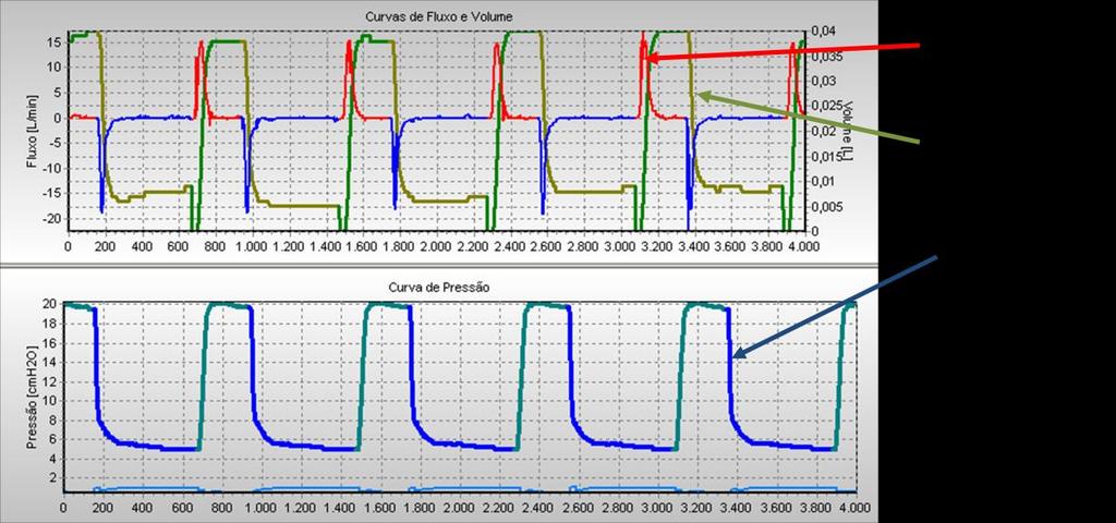 Projeto de Controladores para de Ventilação