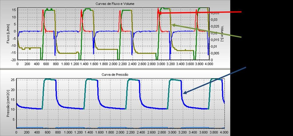 30 e PEEP de 5cmH 2 O.