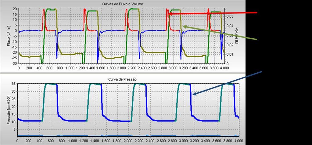 Projeto de Controladores para de Ventilação