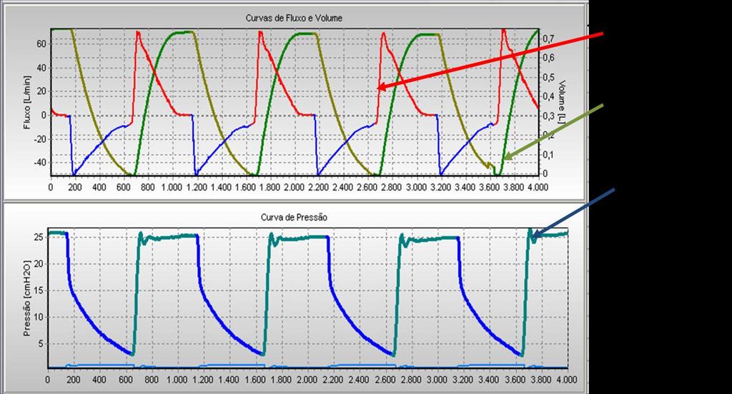 com setpoint de 15cmH 2 O.