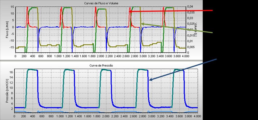 pressão máxima de 7 e PEEP de 2cmH 2 O.