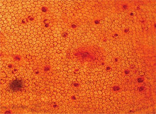 Técnica de separação da membrana de Descemet para transplante de células endoteliais da córnea: estudo experimental em coelhos 25 Figura 3 - Fotografia do endotélio no grupo 3 Figura 4 - Fotografia