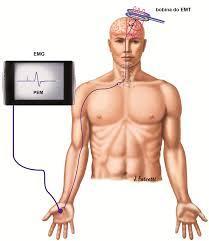 se pretende estimular (área motora); A bobine recebe uma corrente elétrica capaz de gerar um campo magnético que passa através do osso e da pele; Quando essa