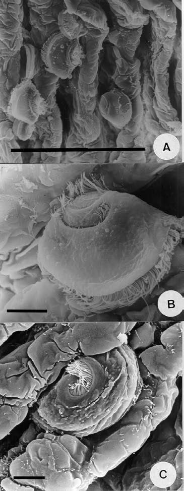 Microscopia eletrônica de varredura de parasitos branquiais 529 mostrado sua ação patogênica em Oncorhynchus keta (Urawa, 1992).