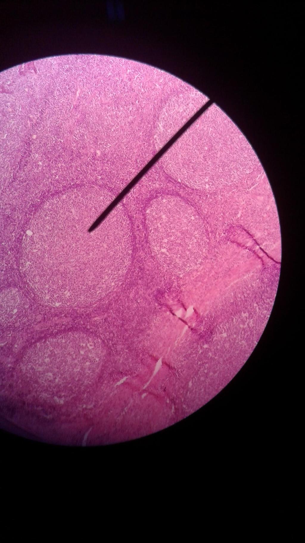 Tonsila Palatina I4 Tecido Linfóide Manto do Nódulo Linfático Centro germinativo do Nódulo Linfático