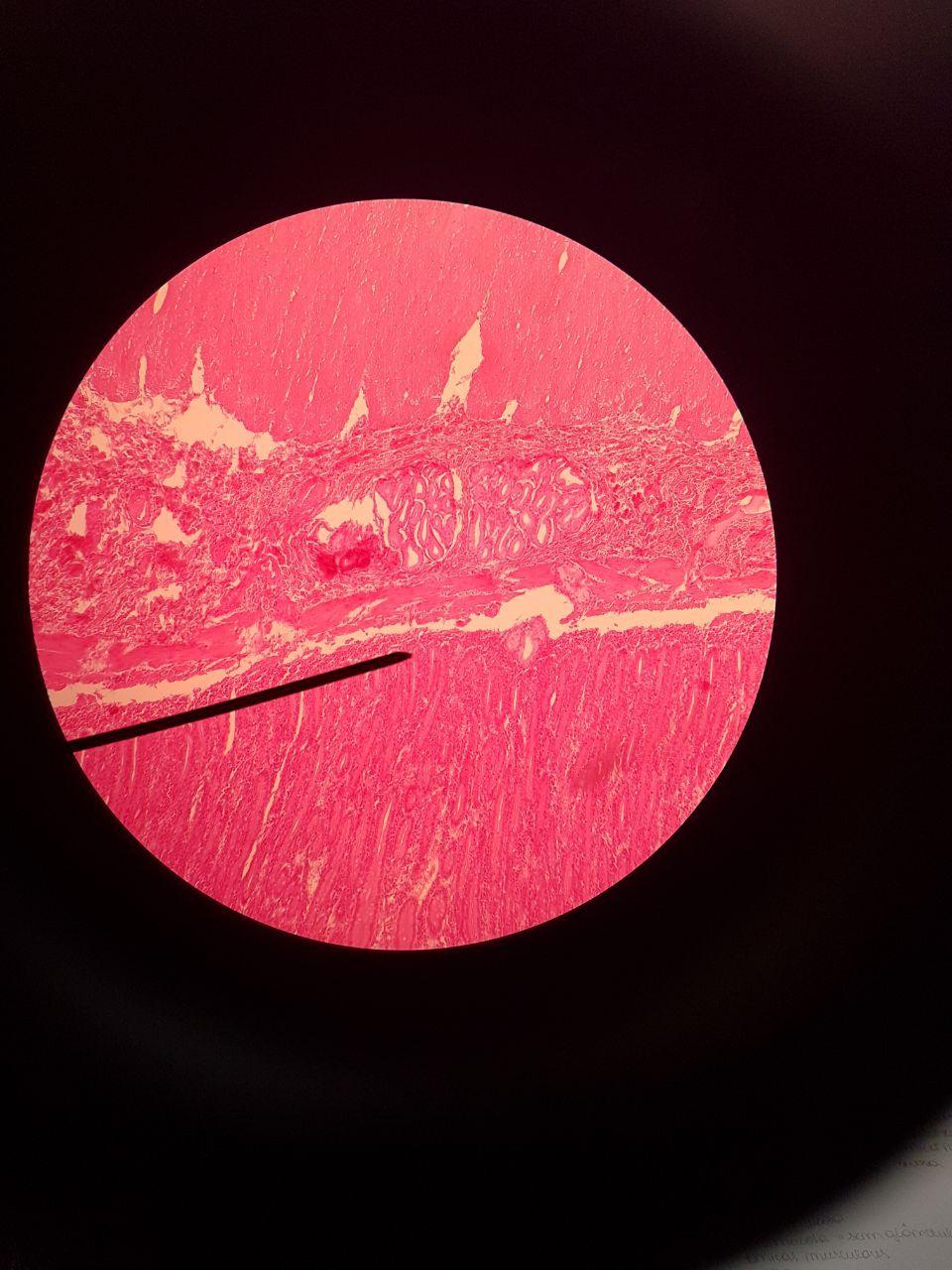 Duodeno= K11 Túnica Muscular Glândulas Duodenais na Submucosa Muscular