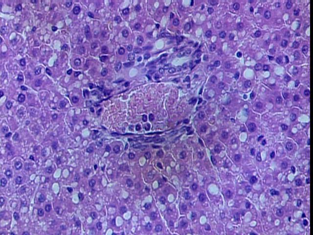 Resultados 125 Figura 16 - Fotomicrografia de corte histológico do fígado de rata, que recebeu 24 mg/kg/dia de KSCN,