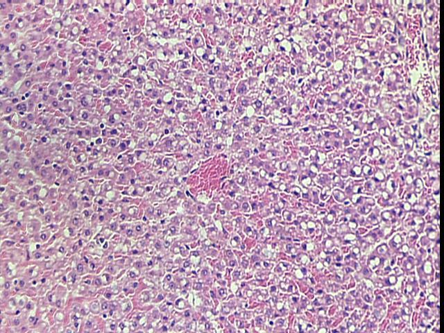 biliares (seta) (HE, 20 X) Figura 17 - Fotomicrografia de corte histológico do fígado de rata, que recebeu 30 mg