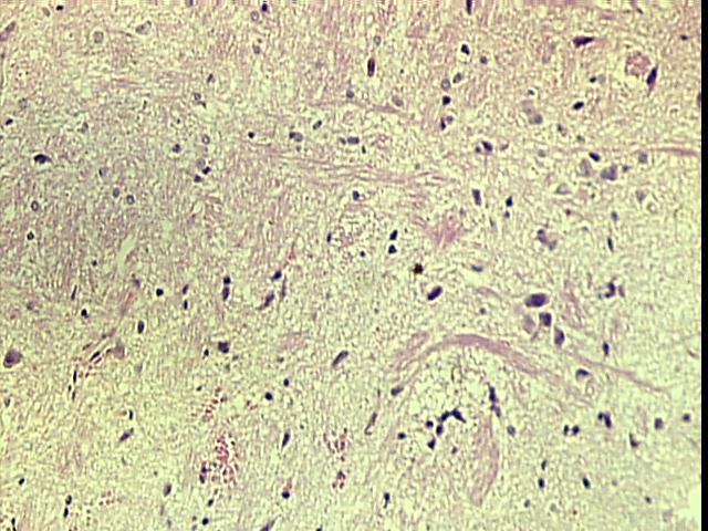 18B - Fotomicrografia de corte histológico do sistema nervoso central de rata, que recebeu 30 mg mg/kg/dia de KCN, na