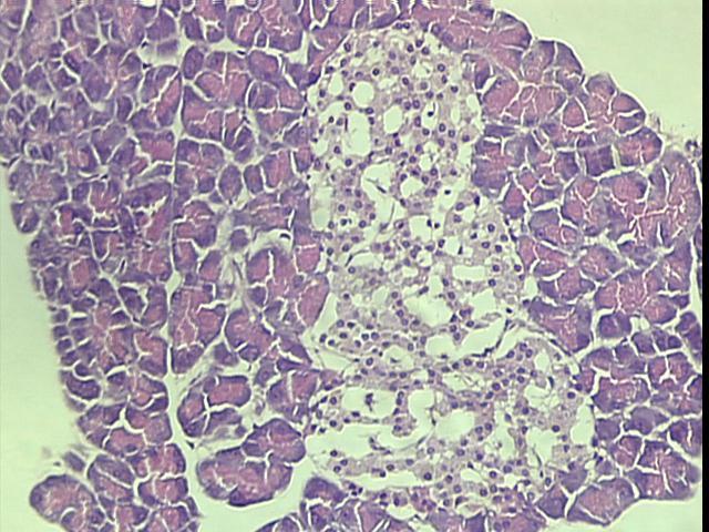 Resultados 129 Figura 21 - Fotomicrografia de corte histológico do pâncreas de