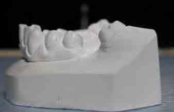 quantidade de dentes utilizada e da padronização das características morfológicas (Figura 5.1.2). FIGURA 5.1.2 Dentes em resina acrílica com características anatômicas semelhantes a dentes naturais.