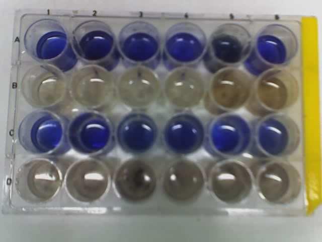 A B A B A Figura 1: A- Controles bióticos e abióticos e B- Ocorrência da oxidação biológica indicada pela descoloração do indicador DCPIP e evidenciada pela descoloração de azul para incolor.