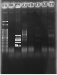 A figura 1 mostra o resultado de PCR para E. canis em gel de agarose, corado com brometo de etídio e visualizado em transiluminador de fluorescência, onde pode ser observado o produto de 398pb.