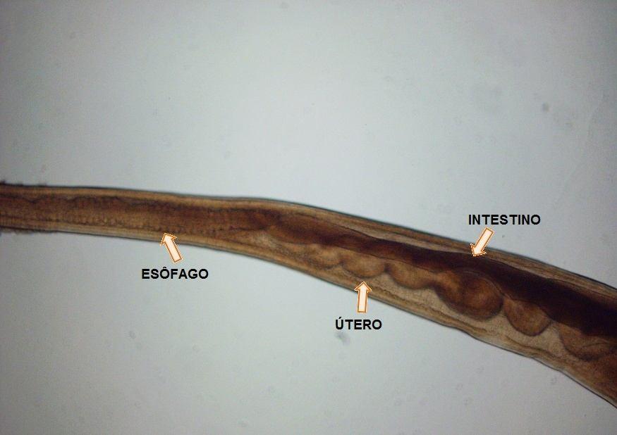 Figura 31: Região da abertura vulvar e da