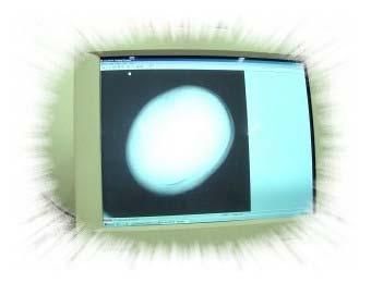 X-Ray 319 Micromax USP/ESALQ Etapa 2: digitalização da imagem radiográfica