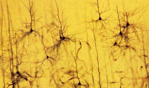 Neurônios do Córtex Motor Primário célula piramidal gigante (soma atinge 100 µm de altura) encontrada quase exclusivamente no