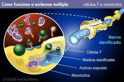 autoimune ou seja, as células de defesa do