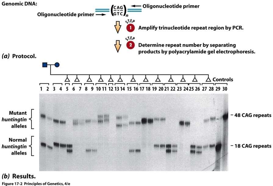 PCR /