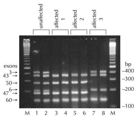 PCR-Multiplex Vários primers específicos em uma mesma