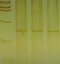 DNA heteroduplex Polimorfismos de um único nucleotídeo;