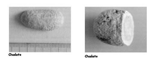 Tipos de urólitos Tipos de urólitos - Lisos - Múltiplos - Redondos ou ovoides - Rugosos a lisos - Projeções afiladas - Com forma de