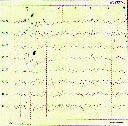 598 Arq Neuropsiquiatr 1998;56(3-B) Fig 3.