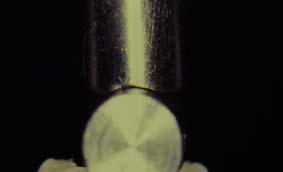 A figura 2 mostra a imagem de radiografia obtida e o contorno do dente obtido no Programa Matlab.
