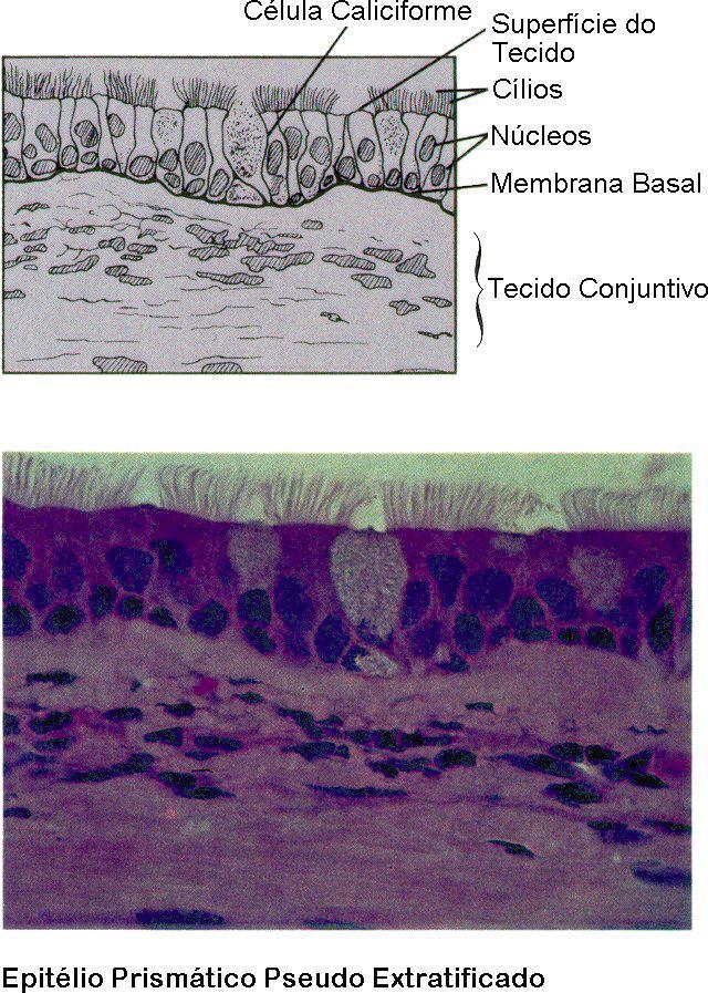 Epitélio Cilíndrico Pseudo- Estratificado Ciliado Similar ao tecido cilíndrico simples Parecem estratificados, mas todas as células se ligam a membrana basal.