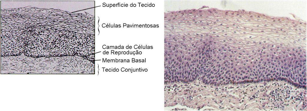 Epitélio Pavimentoso Estratificado Muitas camadas de células- tecido espesso Células do topo são achatadas enquanto as das camadas mais profundas são cubóides ou cilíndricas.