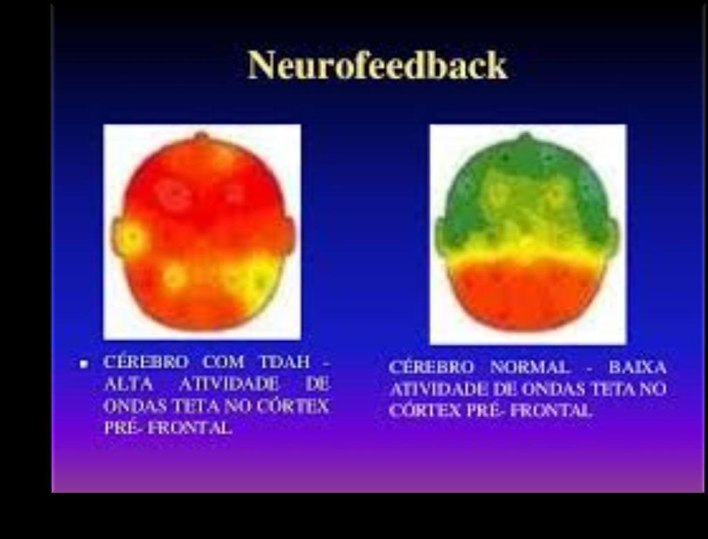 O cérebro e o TDA/TDAH Acesso: https://www.youtube.com/watch?