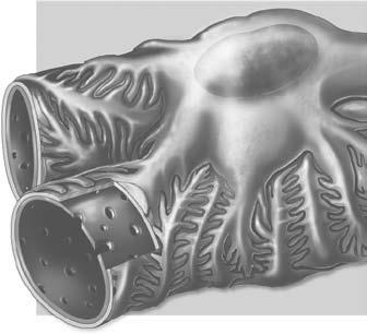 Corpúsculo renal O corpúsculo renal é uma esfera oca (cápsula de Bowman) composta de células epiteliais.