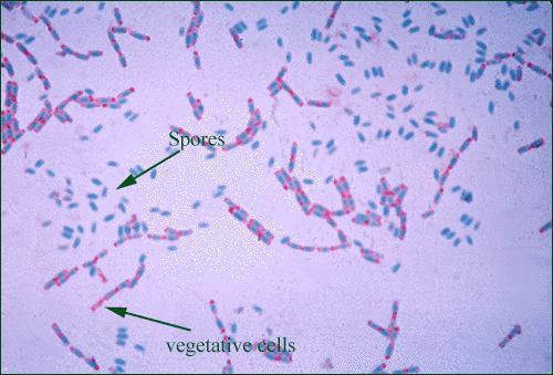 Coloração de Schaeffer-Fulton Bacillus anthracis Endósporos e células vegetativas Localização, tamanho e