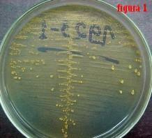Meio Diferencial Utilizado para fácil detecção da colônia da bactéria de interesse quando existem outras bactérias crescendo na mesma placa do meio Substâncias utilizadas como indicadores de