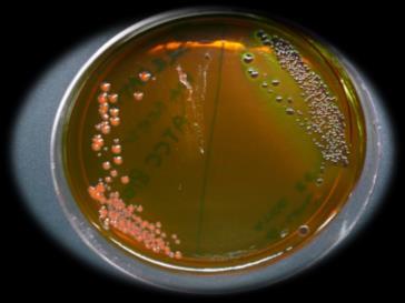natural Meio EMB Escherichia coli