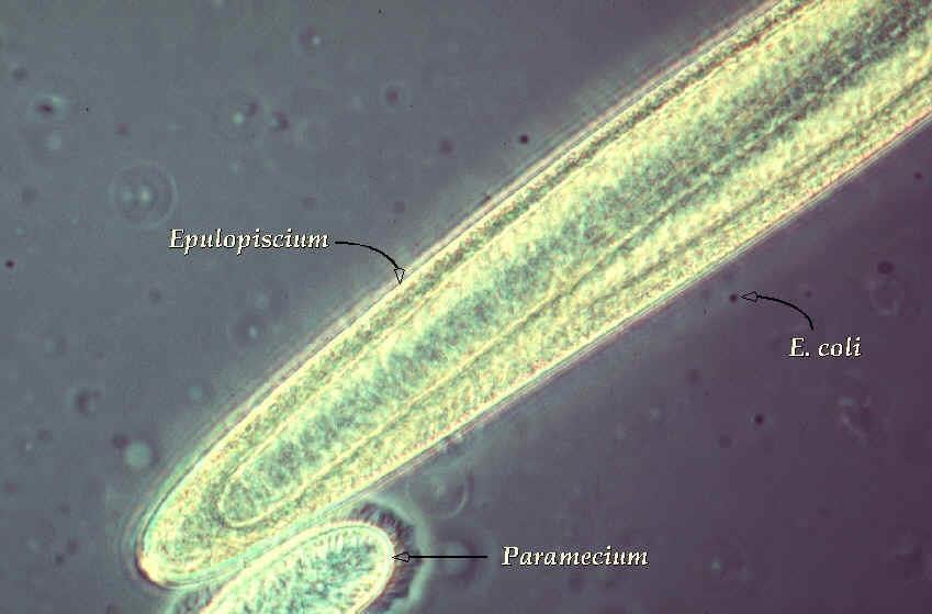 Tamanho das células - gigantes Epulopiscium sp,